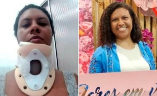 Claudia Lima sofreu um grave acidente. (Foto: Site Mulher Cristã).