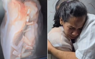 Marcilene dos Santos durante o ultrassom. (Foto: Reprodução/Instagram/George Morais Ferreira)