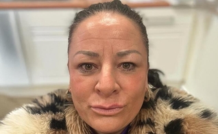 Carly Peek atua no ministério ajudando pessoas a se libertarem dos vícios. (Foto: Arquivo pessoal)