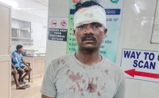 Cristão ferido durante os ataques promovidos por nacionalistas hindus. (Foto: Reprodução/ICC)