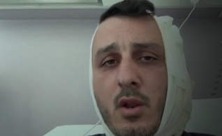 Stav Ben-Shushan após receber atendimento hospitalar por ferimento na orelha. (Captura de tela/Canal 12)