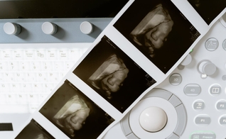 Atualmente, o aborto é permitido até a 24ª semana de gestação. (Foto: Pexels/Mart Production)