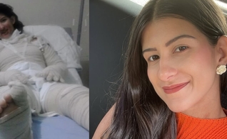 Gabriela Schell sobreviveu a um grave acidente com fogo. (Foto: Reprodução/Instagram/Gabriela Schell).