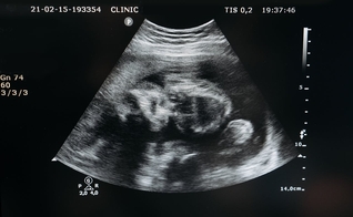 Mudança no Código Civil reconhece personalidade legal ao feto. (Foto: Pavel Danilyuk / Pexels)