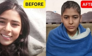 Zarnab Noor antes e depois de ser torturada por seus empregadores muçulmanos. (Foto: Samaritan’s Fellowship Foundation).