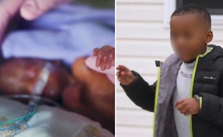 Samuel sobreviveu a várias complicações médicas. (Foto: Reprodução/CBN News)