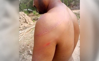 O pastor Motu Sodi após as agressões. (Foto: Reprodução/Morning Star News)
