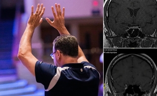 O tumor desapareceu do cérebro do homem no segundo exame. (Foto: Imagem ilustrativa/Unsplash/Jesus Loves Austin/Instagram/Shakersplaces).