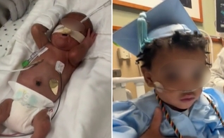Após 11 meses na UTIN, Adonis recebeu alta. (Foto: Reprodução/CBS News)