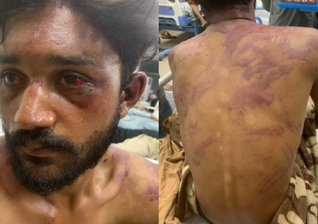 Ikhlaq Masih no hospital. (Foto: International Christian Concern).