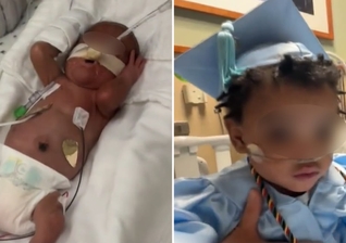 Após 11 meses na UTIN, Adonis recebeu alta. (Foto: Reprodução/CBS News)