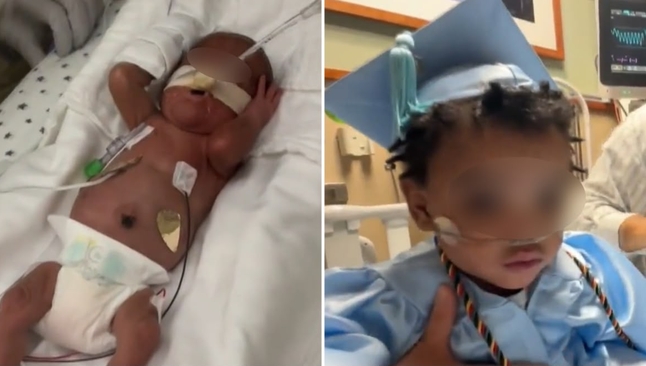 Após 11 meses na UTIN, Adonis recebeu alta. (Foto: Reprodução/CBS News)