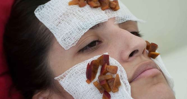 acne facial