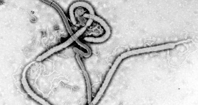 doença Ebola
