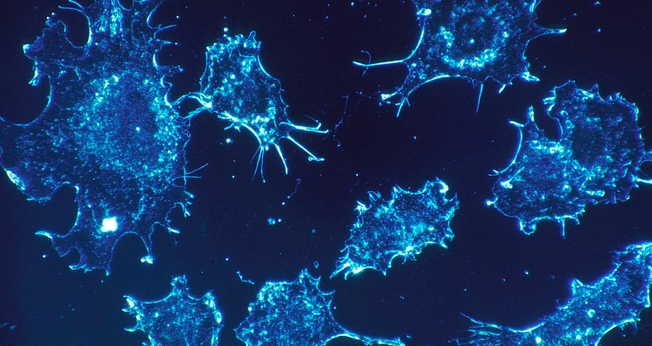 Cientistas acreditam que mortes por câncer serão eliminadas até 2050