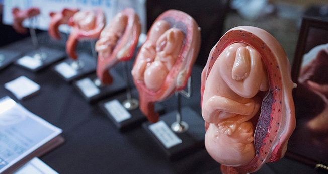 Bebês são desmembrados por médicos abortistas em clínicas de aborto. (Foto: Scott Olson/Getty Images)