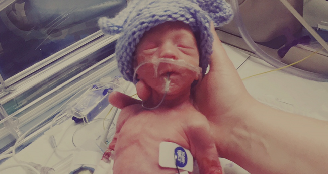 Eli nasceu com pouco mais de 1Kg e foi motivo de celebração para sua família. (Foto: LifeSiteNews)