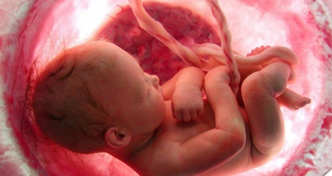 Abortos foram a maior causa de mortes no mundo, em 2018. (Imagem: Aleteia)