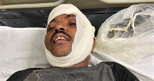 o pastor Isaac Paulose, 48 anos, foi espancado e atropelado cinco vezes por motos. (Foto: Morning Star News)