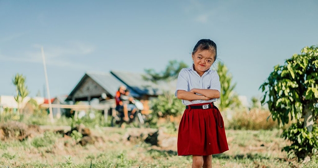 Karunia nasceu com Síndrome de Apert, mas não deixou de se sentir confiante. (Foto: Compassion International)