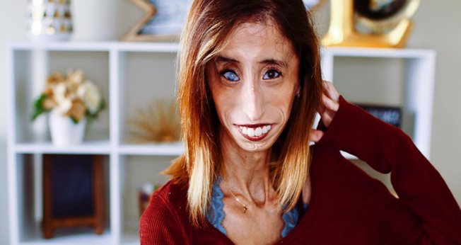 Lizzie Velasquez inspira milhões de pessoas com sua história de superação. (Foto: Reprodução/Instagram)