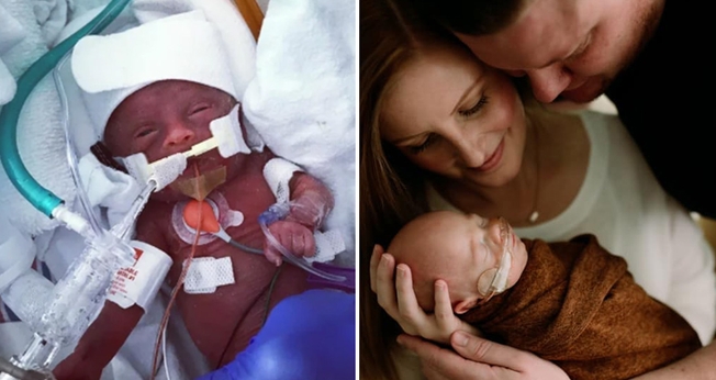 James “Finn” Hill na UTI Neonatal (à esquerda) e com seus pais Chris e Jessica após alta hospitalar. (Foto: Reprodução/Facebook)