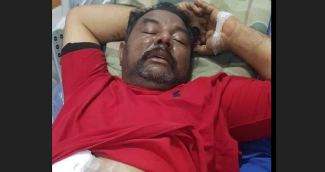 Nadeem Joseph após ser ferido a bala por muçulmanos. (Foto: Reprodução / Herald Malaysia)