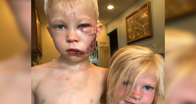 Bridger Walker (esquerda) defendeu sua irmã e evitou que ela fosse atacada por um cachorro. (Foto: Instagram)