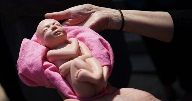 A França realiza cerca de 220.000 abortos legais todos os anos. (Foto: Mandel Ngan / AFP / Getty)