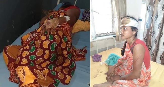 O pastor Rajesh Gupta e sua família foram brutalmente atacados por radicais armados durante um momento de oração na casa de outro cristão. (Imagens: Asia News)