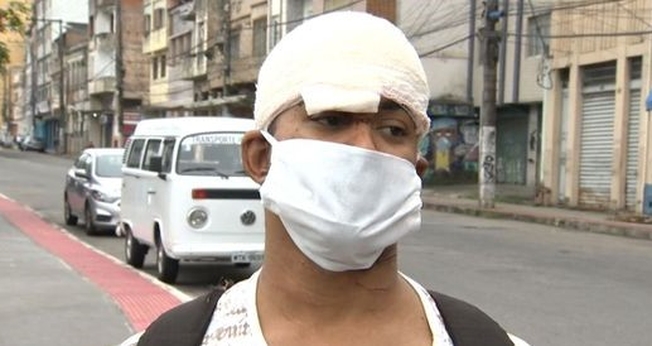 Silas Neves da Silva sofreu ferimentos na cabeça e pescoço. (Foto: Reprodução / TV Gazeta)