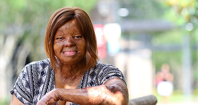 Kechi Okwuchi sobreviveu a uma queda de avião em 2005 na Nigéria. (Foto: Daily Word)