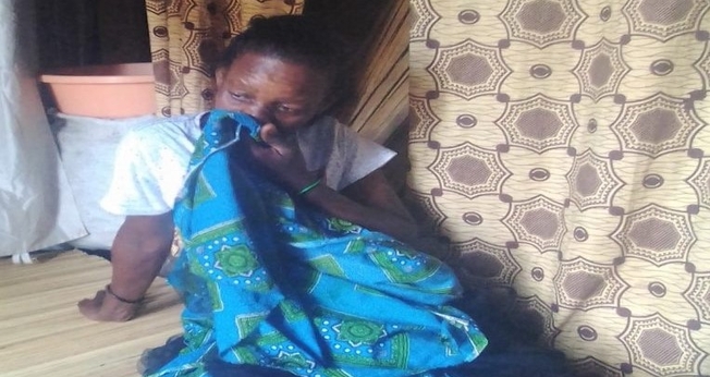 Mansitula Buliro disse que, como retaliação, seu marido cortou sua boca e se divorciou dela. (Foto: Reprodução / Morning Star News)