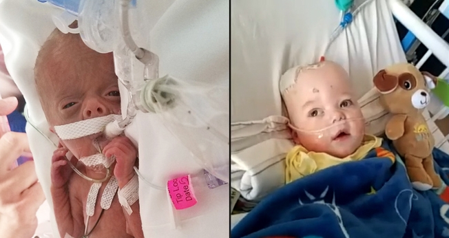 Kingston Lane passou os primeiros 10 meses de vida em uma batalha. (Foto: Brittany Lane/Facebook|WFIE)