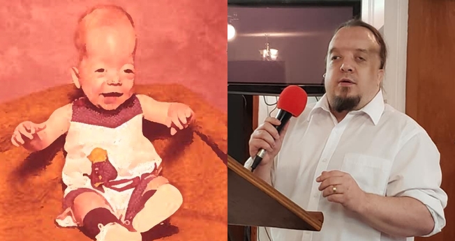 Jacob Phillips nasceu com uma sentença de morte, mas sua família lutou por ele em oração. (Foto: Facebook/Sons of Righteousness Ministries).