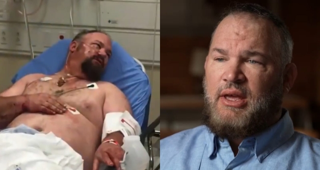 Buck Hornsby sobreviveu ao ataque de um assassino em série, nos EUA. (Foto: Reprodução/CBN News).