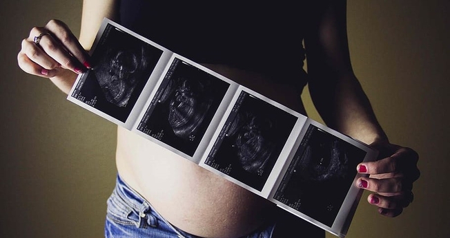 As pesquisas dizem que a maioria da população apoia o direito ao aborto na Espanha. (Foto ilustrativa: Piqsels)