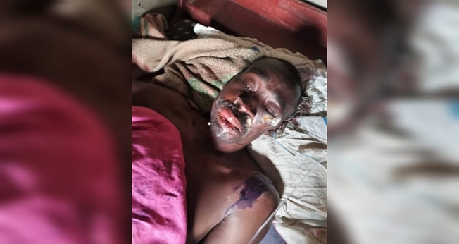 Frank Mutabaazi sofreu uma emboscada de um extremista, em Kampala. (Foto: Morning Star News).