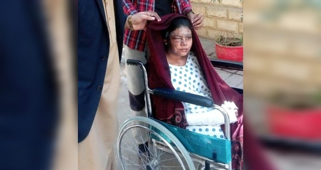 Sunita Masih, de 19 anos, sofreu queimaduras em 20% de seu corpo. (Foto: Morning Star News).