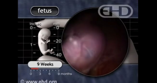 Imagens de ressonância magnética de um embrião humano de nove semanas. (Captura de tela/YouTube/ehdvideos)