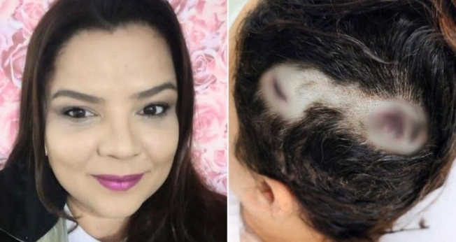 Fernanda Marcelino sobreviveu por um milagre. (Foto: Arquivo pessoal/G1)