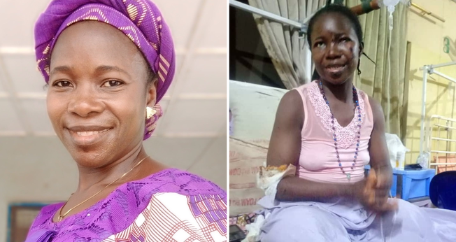 Margaret Attah, antes e depois do atentado terrorista em igreja da Nigéria. (Foto: Acnuk)