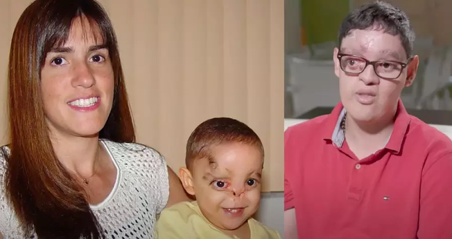 Gray sobreviveu milagrosamente. (Foto: Reprodução/YouTube/American Society of Plastic Surgeons).