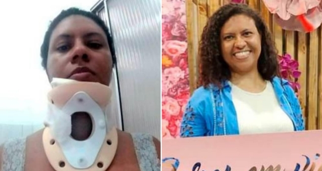 Claudia Lima sofreu um grave acidente. (Foto: Site Mulher Cristã).