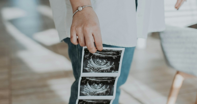 Os dados também apontaram um aumento nos abortos repetidos. (Foto: Unsplash/Rebeca Alvidrez)