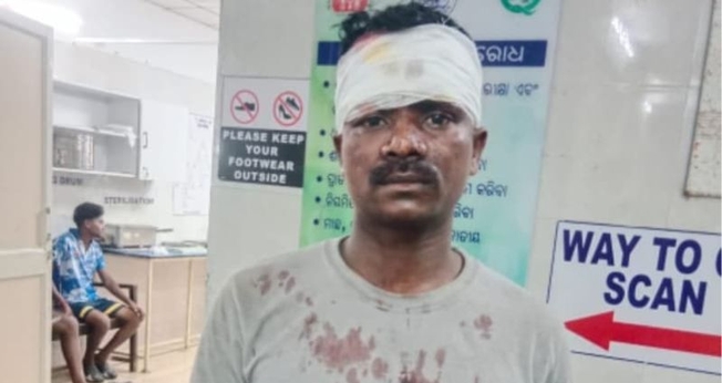Cristão ferido durante os ataques promovidos por nacionalistas hindus. (Foto: Reprodução/ICC)