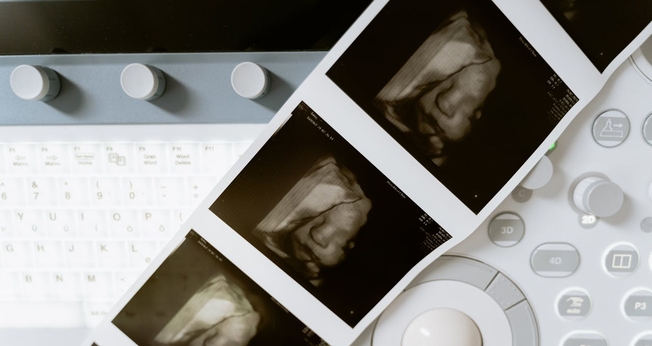 Atualmente, o aborto é permitido até a 24ª semana de gestação. (Foto: Pexels/Mart Production)