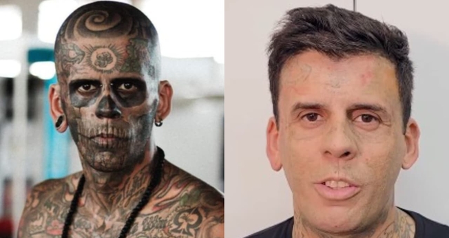 Leandro de Souza passou por mais uma sessão de remoção das tatuagens no rosto. (Foto: Arquivo pessoal/Reprodução/Instagram/Hell Tattoo).
