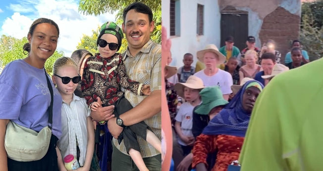 Daniel e Lorena Mallmann estão levando o amor de Deus à comunidade albina. (Foto: Reprodução/Instagram/Daniel Mallmann).