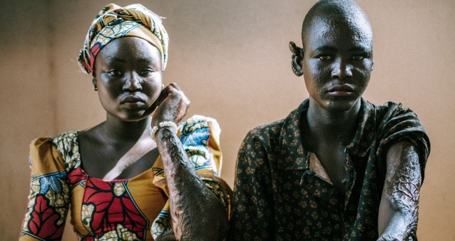 Nancy e Philemon. (Foto: Reprodução/Global Christian Relief)